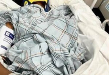 POZNATA GLUMICA DOŽIVELA STRAVIČNU NESREĆU NA DOČEKU! Vozač je udario i pobegao – “Molite se za mene, ne mogu da hodam!”