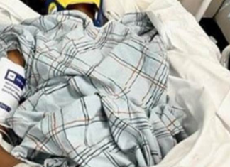 POZNATA GLUMICA DOŽIVELA STRAVIČNU NESREĆU NA DOČEKU! Vozač je udario i pobegao – “Molite se za mene, ne mogu da hodam!”