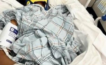 POZNATA GLUMICA DOŽIVELA STRAVIČNU NESREĆU NA DOČEKU! Vozač je udario i pobegao – “Molite se za mene, ne mogu da hodam!”