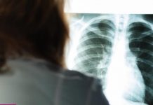 KARLEUŠA IMALA INFARKT PLUĆA! Pjevačica 20 dana bila prikovana za krevet: “Dva tromba su se otkačila i otišla gdje ne treba”