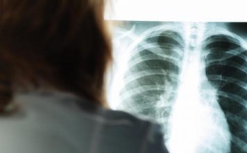 KARLEUŠA IMALA INFARKT PLUĆA! Pjevačica 20 dana bila prikovana za krevet: “Dva tromba su se otkačila i otišla gdje ne treba”