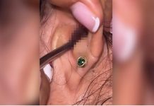 SVRBELO JE UVO DO BESVESTI, OTIŠLA U BOLNICU, A TAMO ŠOK: Kada su videli šta je unutra nisu mogli da veruju svojim očima! (FOTO)