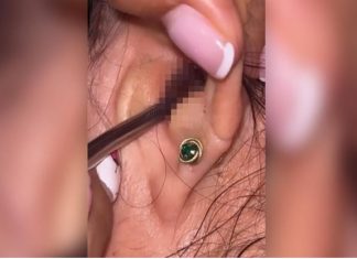 SVRBELO JE UVO DO BESVESTI, OTIŠLA U BOLNICU, A TAMO ŠOK: Kada su videli šta je unutra nisu mogli da veruju svojim očima! (FOTO)