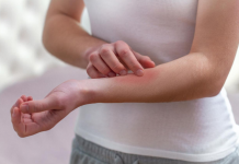 Kako se bolesna jetra manifestira na koži i nogama? OVO SU ZNAKOVI BOLESNE JETRE… (SLIKA)