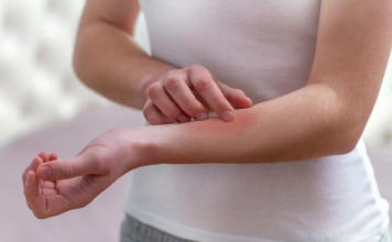 Kako se bolesna jetra manifestira na koži i nogama? OVO SU ZNAKOVI BOLESNE JETRE… (SLIKA)