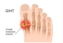 IZBACITE MOKRAĆNU KISELINU IZ TIJELA, IZBACITE GIHT: 3 narodna lijeka koja provjereno djeluju, EVO ŠTA ĆE VAM POMOĆI! (RECEPT)