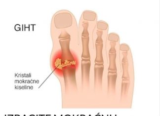 IZBACITE MOKRAĆNU KISELINU IZ TIJELA, IZBACITE GIHT: 3 narodna lijeka koja provjereno djeluju, EVO ŠTA ĆE VAM POMOĆI! (RECEPT)
