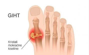 IZBACITE MOKRAĆNU KISELINU IZ TIJELA, IZBACITE GIHT: 3 narodna lijeka koja provjereno djeluju, EVO ŠTA ĆE VAM POMOĆI! (RECEPT)