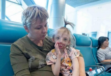 Jelena rodila dete bez pola lica, onesvestila se od šoka kad je videla: Svi su iznenađeni kako sad ova devojčica izgleda