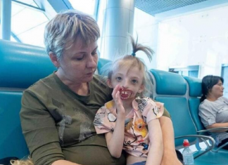 Jelena rodila dete bez pola lica, onesvestila se od šoka kad je videla: Svi su iznenađeni kako sad ova devojčica izgleda