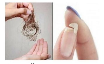 Ne možete spavati, nokti su vam krhki ili vam opada kosa: ovo vaše tijelo traži