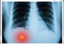 Imate li bol ispod desnog rebra? Ovo može biti ozbiljan problem: većina ljudi ne shvata da se bolest razvila do prvih stadijuma