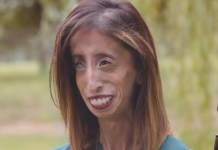 Sa 35 godina i 29 kilograma proglašena je najružnijom ženom na svetu: A kad čuju čime se bavi, ljudi ostanu u čudu