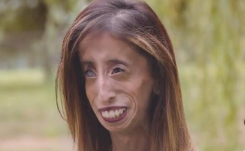 Sa 35 godina i 29 kilograma proglašena je najružnijom ženom na svetu: A kad čuju čime se bavi, ljudi ostanu u čudu