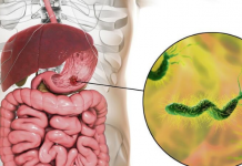 Ova bakterija je najveći neprijatelj želuca: Lako se zarazite, a posledice mogu biti opasne – obratite pažnju na 1 stvar