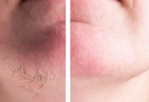 DLAČICE S LICA nestaju kao rukom odnesene:Sve žene širom svijeta potpuno su poludile za ovim receptom!