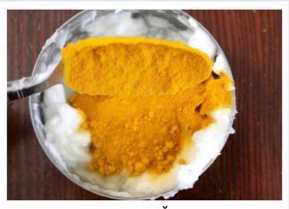 Kurkuma sprečava zgrušavanje krvi i smanjuje rizik od šloga: Evo kako se konzumira – OVA GRUPA TREBA DA JE IZBEGAVA