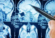 Najzdravije p0vrće na svijetu: Naučnici kažu da mozak može učiniti 11 godina mlađim