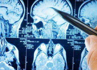 Najzdravije p0vrće na svijetu: Naučnici kažu da mozak može učiniti 11 godina mlađim