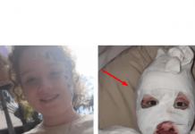 APEL RODITELJIMA! Djevojčica (8) obukla duksericu s Temua, jedva je preživjela