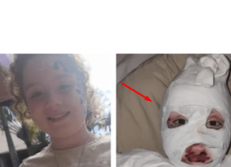 APEL RODITELJIMA! Djevojčica (8) obukla duksericu s Temua, jedva je preživjela