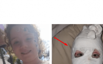 APEL RODITELJIMA! Djevojčica (8) obukla duksericu s Temua, jedva je preživjela