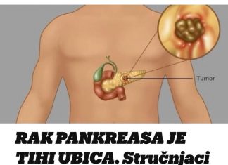 Rak gušterače je tihi ubojica. Stručnjaci podsjećaju da obratite pozornost na pet glavnih simptoma