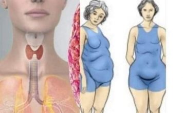 Štitnjača igra ključnu ulogu u regulaciji hormona i održavanju zdrave težine, bilo da se radi o pretjeranoj mršavosti ili debljini