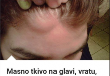 MASNO TKIVO NA VRATU, ISPOD PAZUHA, RUCI EVO KAKO GA UKLONITI