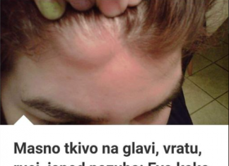 MASNO TKIVO NA VRATU, ISPOD PAZUHA, RUCI EVO KAKO GA UKLONITI