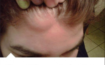 MASNO TKIVO NA VRATU, ISPOD PAZUHA, RUCI EVO KAKO GA UKLONITI