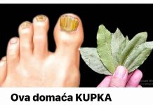 Ova domaća KUPKA trenutno ubija gljivice na noktima: Pomoći će čak i u najgorim slučajevima!