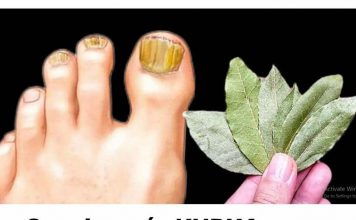 Ova domaća KUPKA trenutno ubija gljivice na noktima: Pomoći će čak i u najgorim slučajevima!