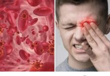 OVO SU SIMPTOMI NISKOG ŽELJEZA U KRVI: Tijelo vas upozorava JEDNIM SIMPTOMOM – ODMAH REAGUJTE