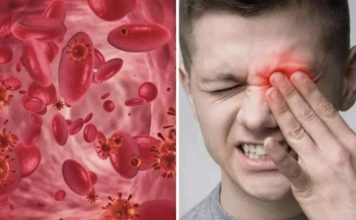 OVO SU SIMPTOMI NISKOG ŽELJEZA U KRVI: Tijelo vas upozorava JEDNIM SIMPTOMOM – ODMAH REAGUJTE