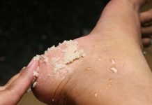 GENIJALAN RECEPT ZA GRUBE RUKE, ISPUCALE PETE, KURJE OČI I KRIVE NOKTE NA NOGAMA: Obavezno zapišite, nećete se pokajati GENIJALAN RECEPT ZA GRUBE RUKE, ISPUCALE PETE, KURJE OČI I KRIVE NOKTE NA NOGAMA: Obavezno zapišite, nećete se pokajati - featured image