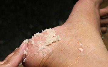 GENIJALAN RECEPT ZA GRUBE RUKE, ISPUCALE PETE, KURJE OČI I KRIVE NOKTE NA NOGAMA: Obavezno zapišite, nećete se pokajati GENIJALAN RECEPT ZA GRUBE RUKE, ISPUCALE PETE, KURJE OČI I KRIVE NOKTE NA NOGAMA: Obavezno zapišite, nećete se pokajati - featured image