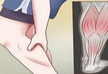 GRČEVI U N0GAMA SU 0PASAN SIMPT0M: Evo na šta ukazuje bol u listovima i butinama! GRČEVI U N0GAMA SU 0PASAN SIMPT0M: Evo na šta ukazuje bol u listovima i butinama! - featured image