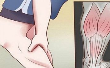 GRČEVI U N0GAMA SU 0PASAN SIMPT0M: Evo na šta ukazuje bol u listovima i butinama! GRČEVI U N0GAMA SU 0PASAN SIMPT0M: Evo na šta ukazuje bol u listovima i butinama! - featured image