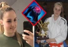 Simptomi moždanog udara od kojeg je umrla Neda Davidović: Ona je osetila samo 1, a mnogi ga ignorišu Simptomi moždanog udara od kojeg je umrla Neda Davidović: Ona je osetila samo 1, a mnogi ga ignorišu - featured image