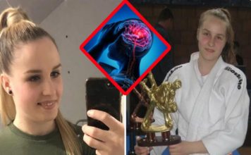 Simptomi moždanog udara od kojeg je umrla Neda Davidović: Ona je osetila samo 1, a mnogi ga ignorišu Simptomi moždanog udara od kojeg je umrla Neda Davidović: Ona je osetila samo 1, a mnogi ga ignorišu - featured image