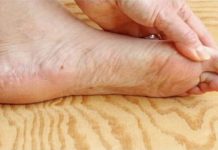 7 znakova da se tijelo već duže vrijeme bori s VISOKIM ŠEĆEROM U KRVI: Prvo ćete to primijetiti na očima i nogama! 7 znakova da se tijelo već duže vrijeme bori s VISOKIM ŠEĆEROM U KRVI: Prvo ćete to primijetiti na očima i nogama! - featured image