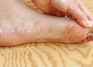 7 znakova da se tijelo već duže vrijeme bori s VISOKIM ŠEĆEROM U KRVI: Prvo ćete to primijetiti na očima i nogama! 7 znakova da se tijelo već duže vrijeme bori s VISOKIM ŠEĆEROM U KRVI: Prvo ćete to primijetiti na očima i nogama! - featured image