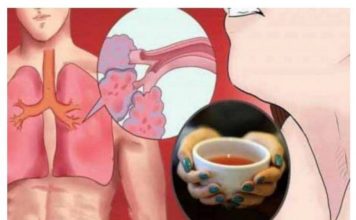 DOKTORI OVO KRIJU: Izbacite sav ŠLAJM IZ PLUĆA I SEKRET IZ SINUSA pomoću ovog prirodnog napitka! DOKTORI OVO KRIJU: Izbacite sav ŠLAJM IZ PLUĆA I SEKRET IZ SINUSA pomoću ovog prirodnog napitka! - featured image