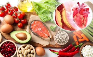 7 namirnica koje snižavaju holesterol: Saveti stručnjaka sa Mejo klinike 7 namirnica koje snižavaju holesterol: Saveti stručnjaka sa Mejo klinike - featured image