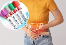 Jedna krvna grupa nosi veći rizik od ozbiljne bolesti jetre: Evo šta otkriva nova studija Jedna krvna grupa nosi veći rizik od ozbiljne bolesti jetre: Evo šta otkriva nova studija - featured image