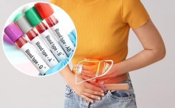 Jedna krvna grupa nosi veći rizik od ozbiljne bolesti jetre: Evo šta otkriva nova studija Jedna krvna grupa nosi veći rizik od ozbiljne bolesti jetre: Evo šta otkriva nova studija - featured image