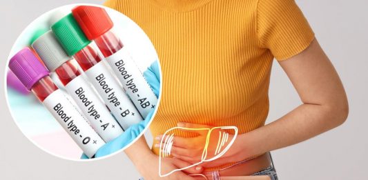 Jedna krvna grupa nosi veći rizik od ozbiljne bolesti jetre: Evo šta otkriva nova studija Jedna krvna grupa nosi veći rizik od ozbiljne bolesti jetre: Evo šta otkriva nova studija - featured image