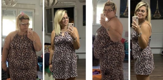 Transformacija koja je zapanjila Balkan: Smršala čak 83 kilograma, a Jelenina ispovijest tjera suze na oči! Jelena je smršala 83 kilograma za 18 meseci: "Hrana nije zamena za bliskost i ljubav, ono što sam zaista skinula bio je teret bola" - featured image