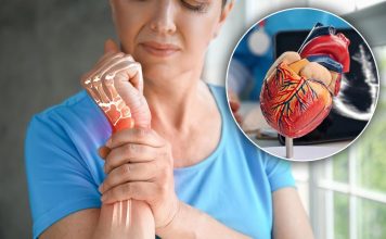 Bolest koja uništava zglobove i srce: Prepoznajte opasnu reumatsku groznicu na vreme Bolest koja uništava zglobove i srce: Prepoznajte opasnu reumatsku groznicu na vreme - featured image